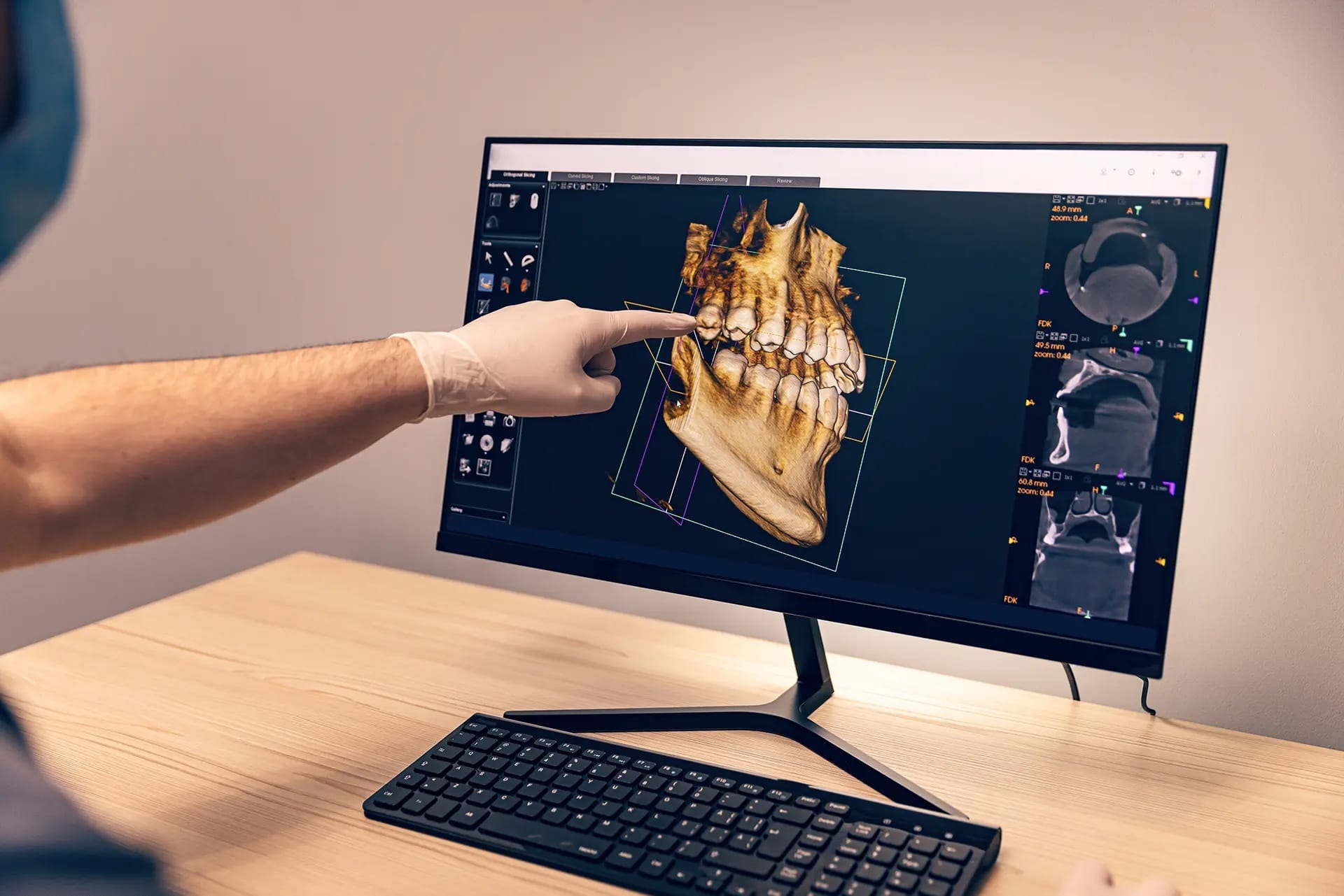 3D dental tomografi ekranında çene ve diş yapısı görüntüleniyor – Antalya CBCT