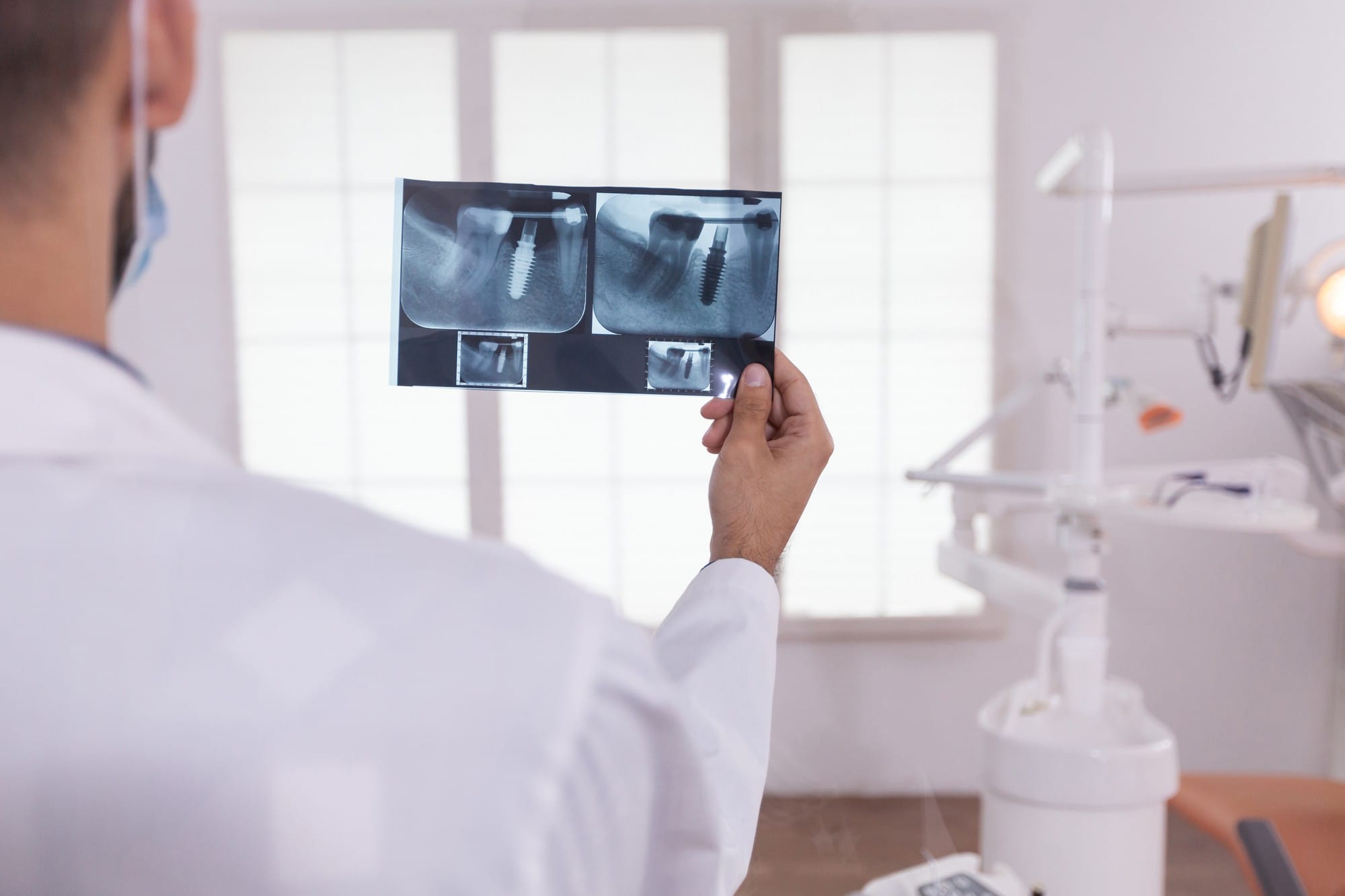 Diş hekimi, periapikal röntgen görüntüsünü inceleyerek diş kökü ve implant durumunu değerlendiriyor