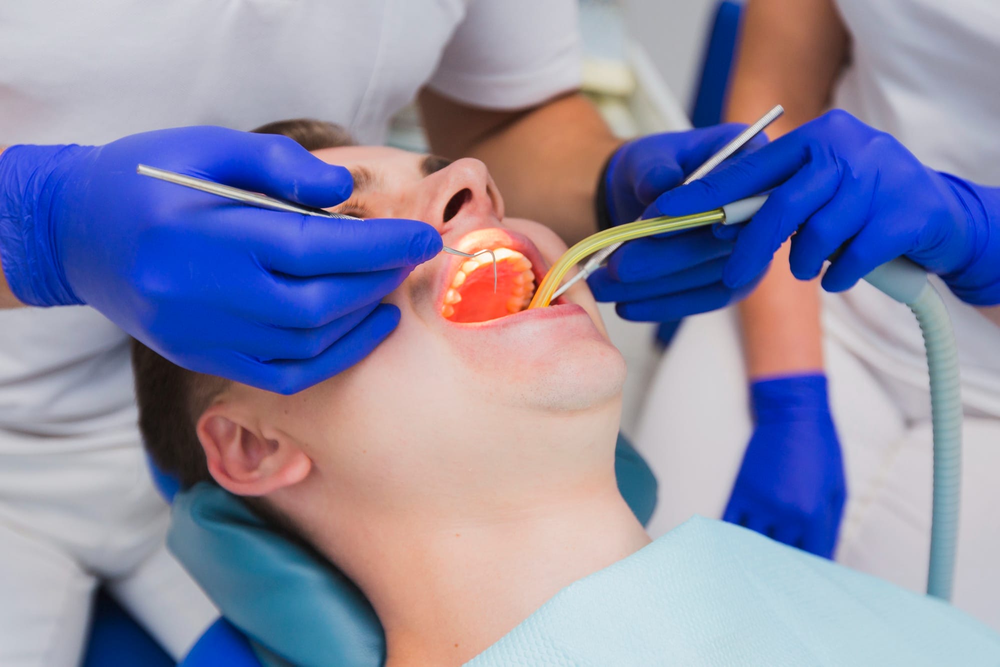 Restoratif ve endodontik diş tedavisi sırasında MRV Dental hekimi tarafından uygulanan kanal tedavisi