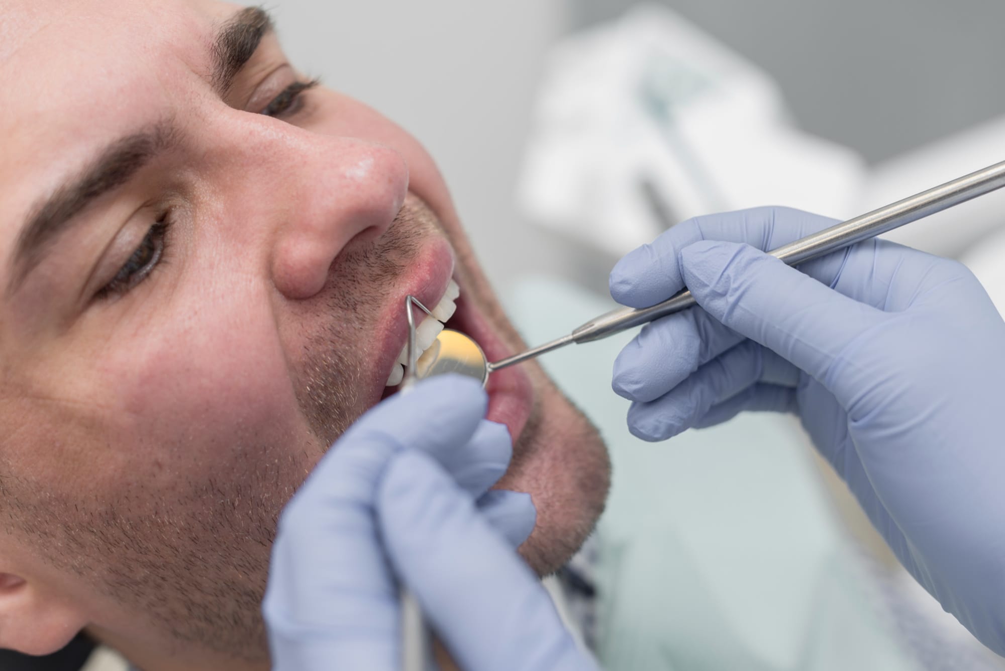 Antalya’da MRV Dental kliniğinde yapılan küretaj (derin diş eti temizliği) uygulaması